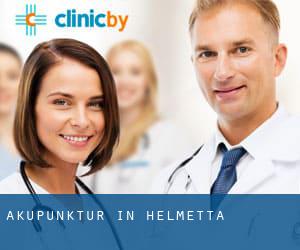 Akupunktur in Helmetta